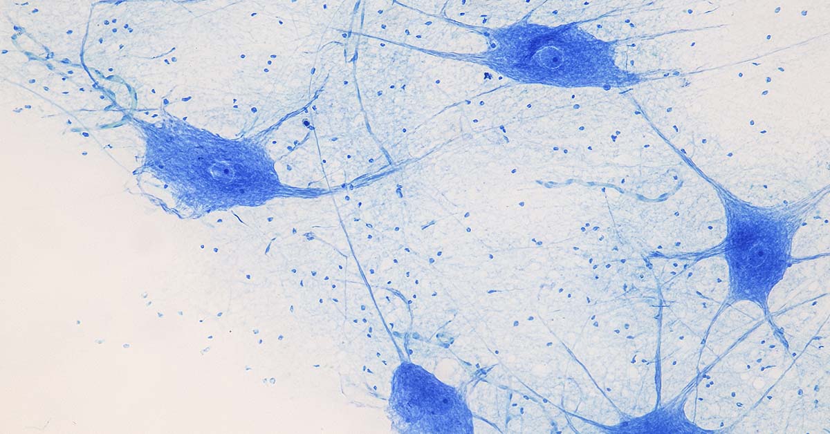 Motor Neuron under the microscope in Lab