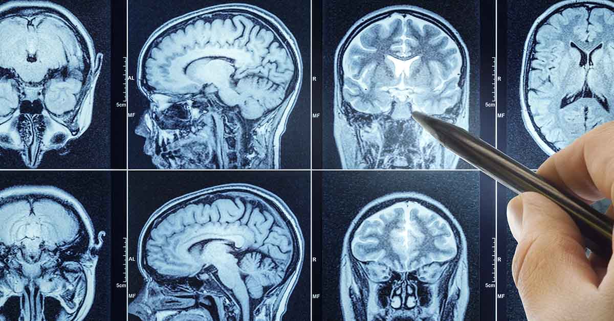 brain scans being examined