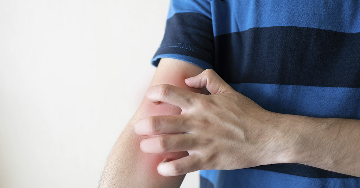 man scratching his itchy arm