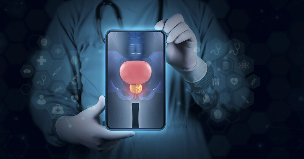 5 Prostate Cancer Symptoms Every Man Should Watch For - Featured image