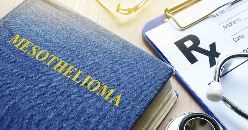 5 Things to Look For in a Lawyer After a Mesothelioma Diagnosis - Featured image