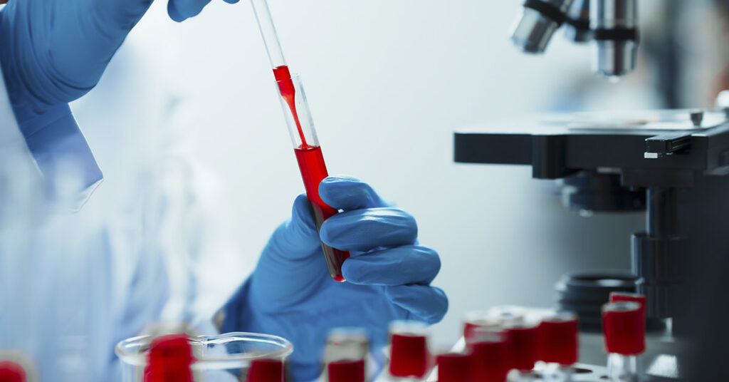 Scientists Edge Closer to Creating Universal Donor Blood - Featured image