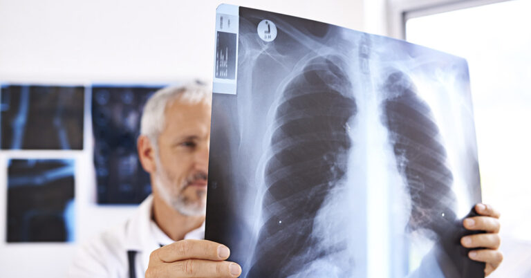 The Surprising Role of Lungs in Blood Formation - Featured image