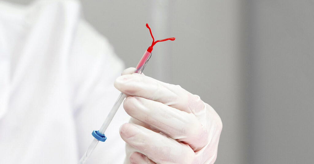 Updated Guidelines Urge Doctors to Address Pain During IUD Insertion - Featured image