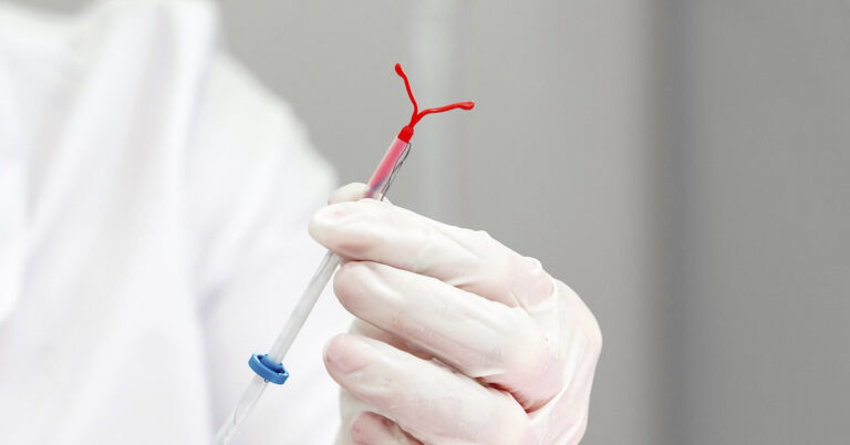 Updated Guidelines Urge Doctors to Address Pain During IUD Insertion - Featured image
