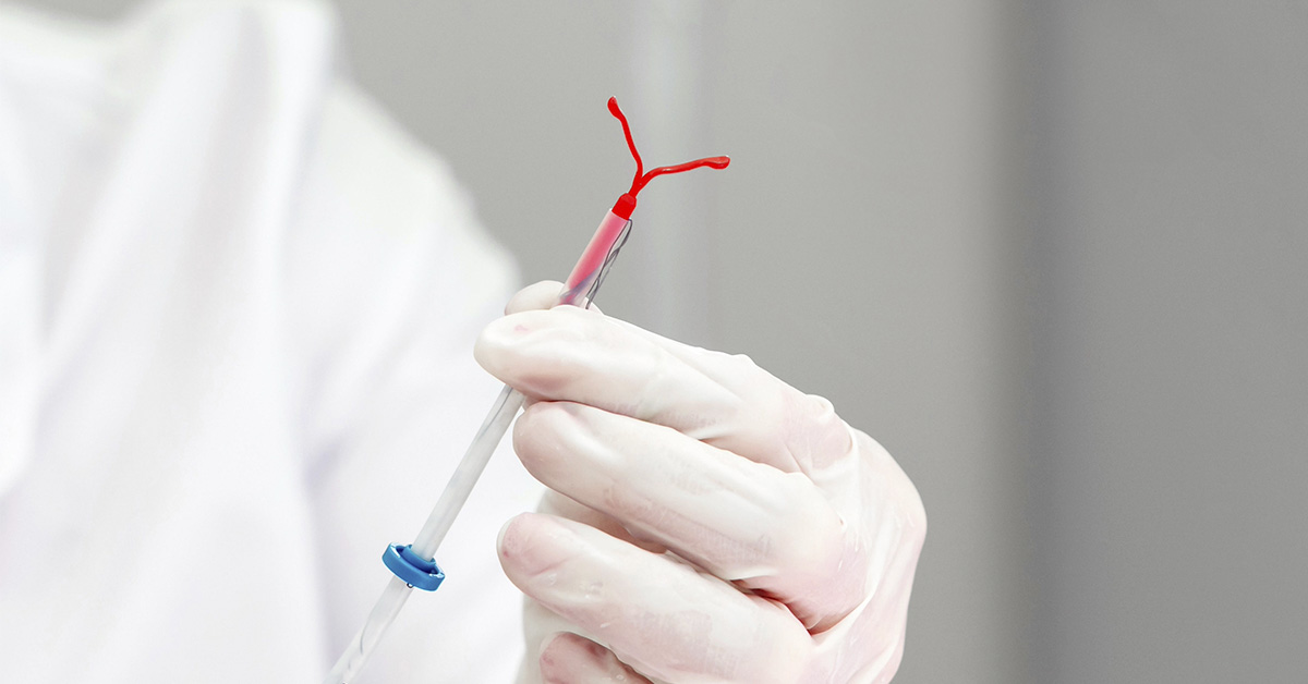 medical professional holding an IUD