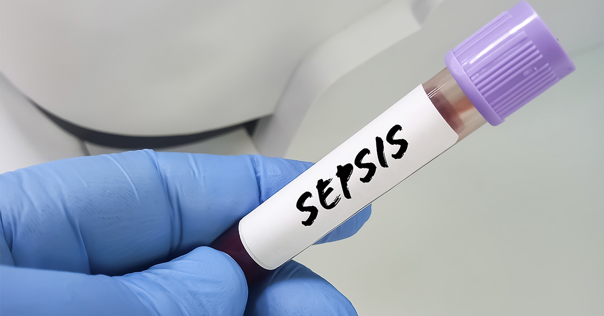 test tube labelled "Sepsis"