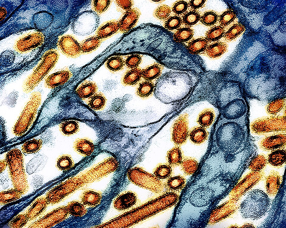 Colorized transmission electron micrograph showing H5N1 bird flu virus particles. The image reveals blue-tinted viral structures with distinctive orange spherical components arranged in clusters and chains. This microscopic view shows the actual pathogen responsible for widespread outbreaks across the United States, affecting all 50 states and causing increasing concern among public health experts.