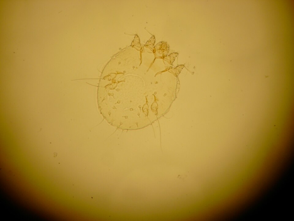Close-up picture of the scabies mite seen through a microscope.