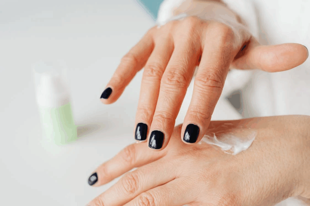 Hands putting medicated cream on skin to treat scabies. You need to cover every spot from your neck to your toes with the cream and leave it on overnight. Don't miss any areas or the mites might survive and cause more problems.