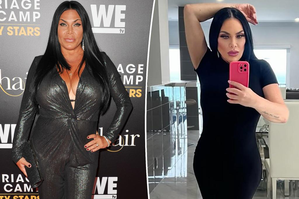 Renee Graziano before and after photos demonstrating dramatic Ozempic mouth effects from rapid weight loss.