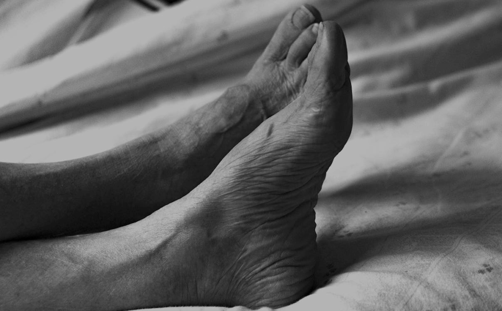Close-up of aged feet showing wrinkled skin texture similar to Ozempic-related body changes.