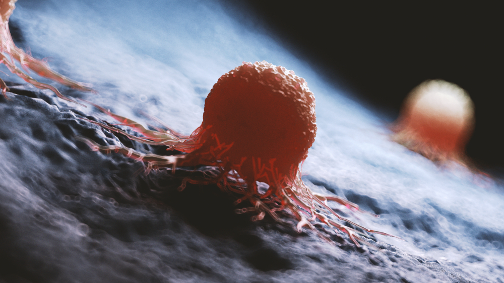 3d rendered medically accurate illustration of a cancer cell
