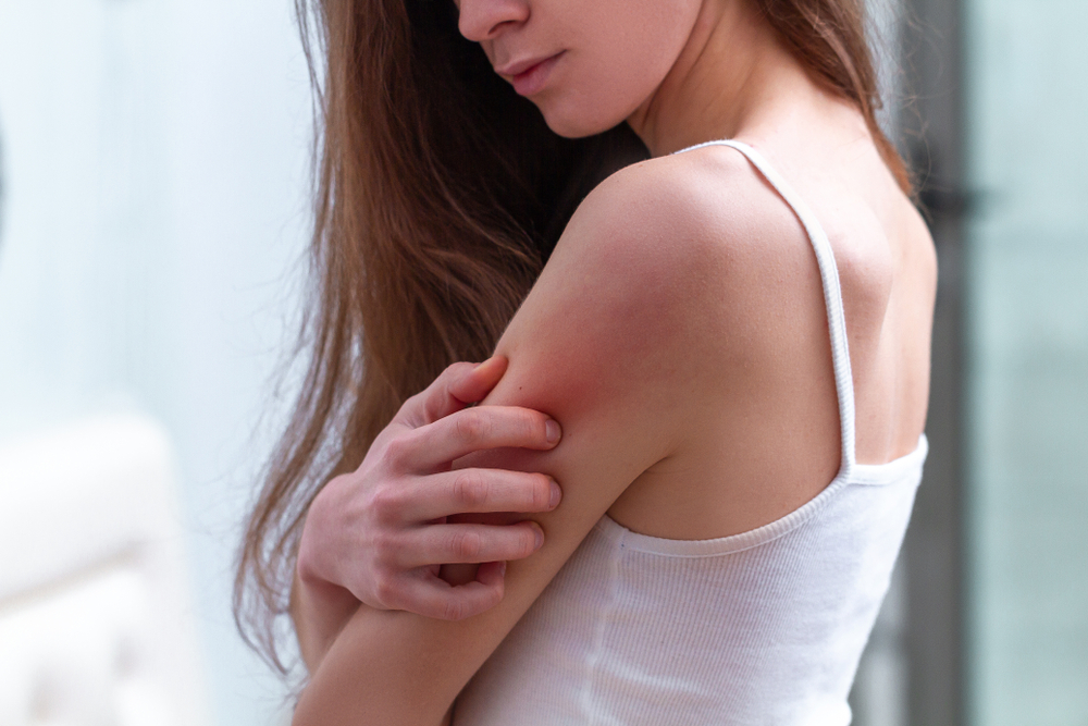 Young woman suffering from itching on her skin and scratching an itchy place. Allergic reaction to insect bites, dermatitis, food, drugs. Health care concept. Allergy rash