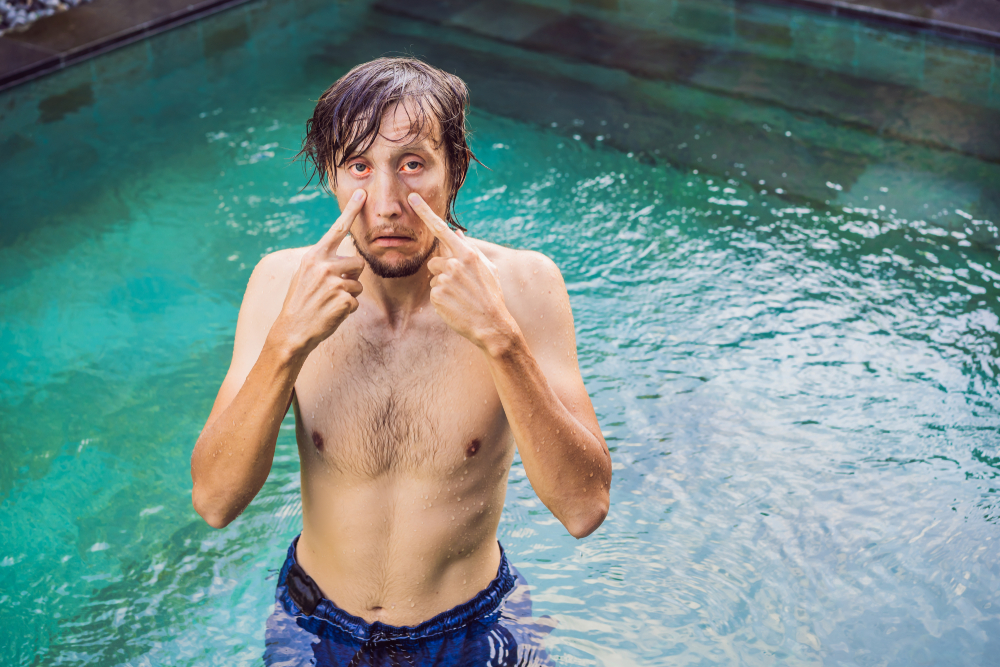 The man has red eyes after the pool