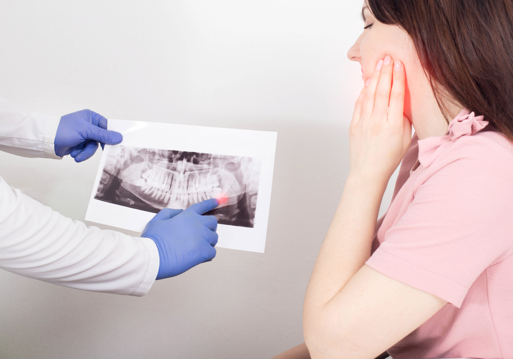 A dentist doctor is holding a panoramic X-ray picture of a female patient who has an inflamed dental cyst, a neoplasm. Removal of a dental cyst, malignant tumor