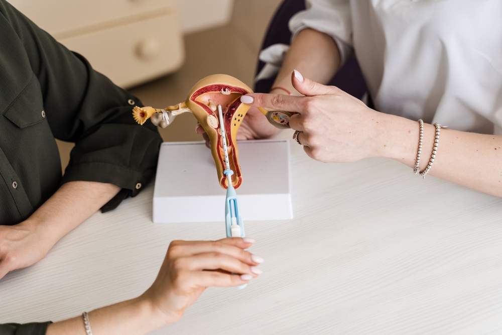 Close-up insert of intrauterine device IUD into your uterus model. Gynecology consultation about IUD intrauterine device is a form of birth control
