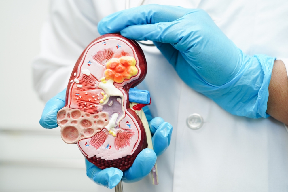 Chronic kidney disease, doctor with model for treatment urinary system, urology, Estimated glomerular filtration rate eGFR.