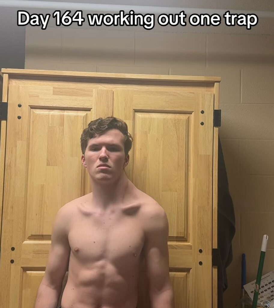 person with one muscle bigger on neck trains one side of body