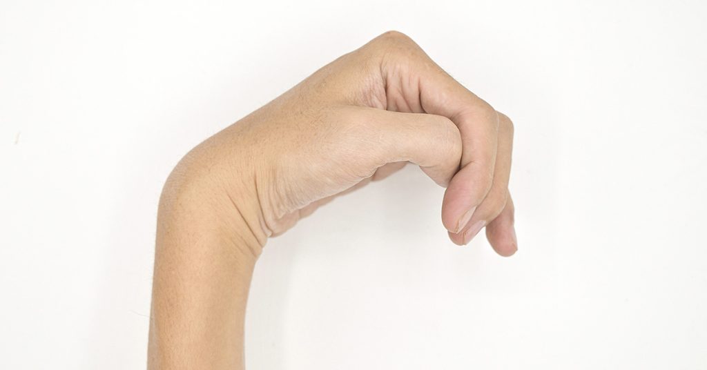What Causes Hemiplegia? Treatment Options for Partial Paralysis - Featured image