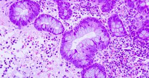 histology slide stained with hematoxylin and eosin (H&E). This is a common staining technique used to visualize cells and tissues under a microscope