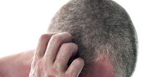 person with very short hair scratching their scalp. Itchy scalp, scalp bump concept