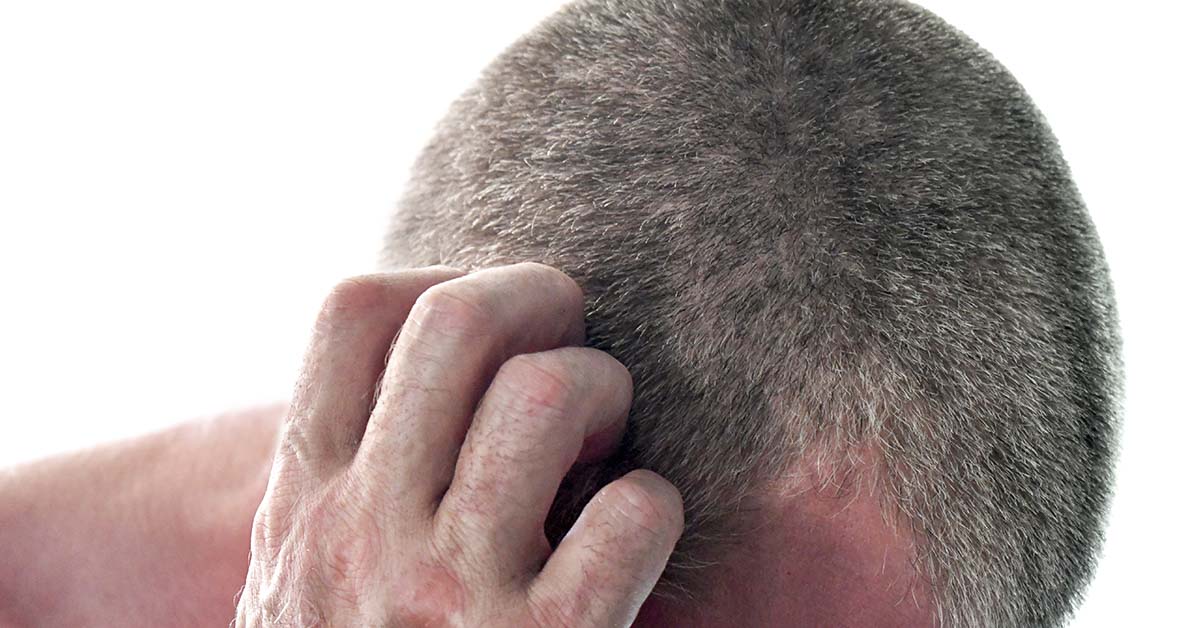 person with very short hair scratching their scalp. Itchy scalp, scalp bump concept