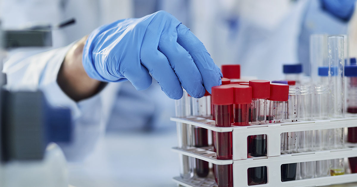 shows a medical professional, likely a phlebotomist, drawing blood from a patient.