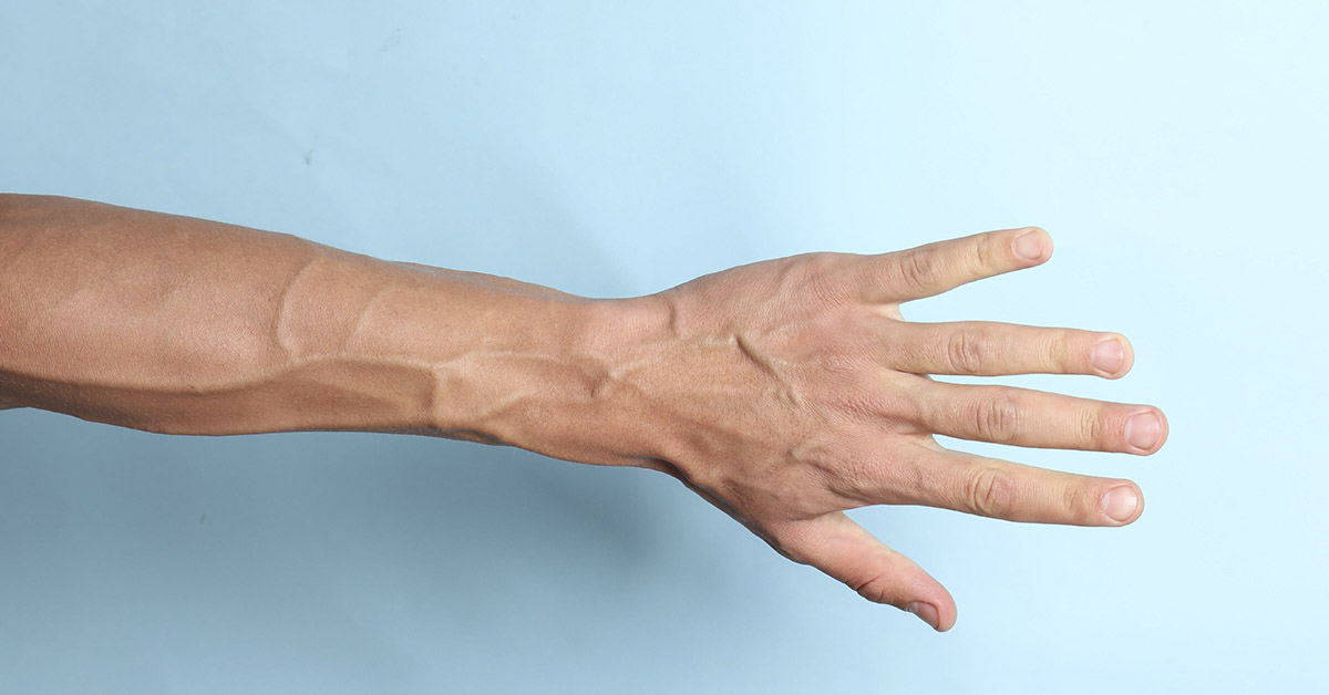 arm with bulging visible veins
