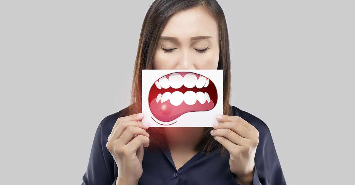 Periodontal disease, Gingivitis or inflammation of the gums