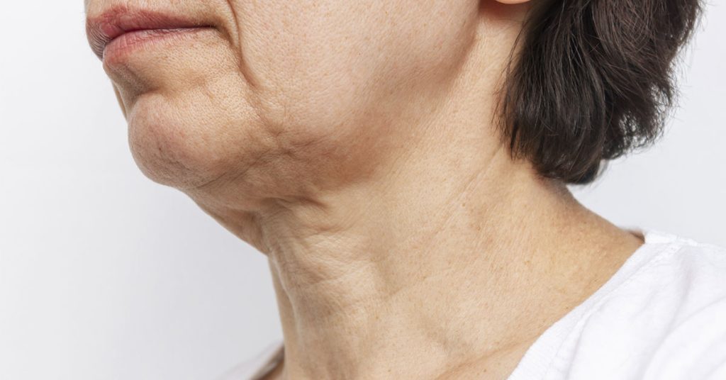 Is The Skin On Your Neck Starting To Sag? Here’s Why And What To Do About It - Featured image