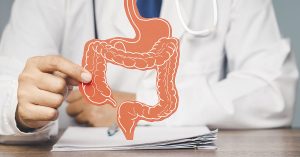 Why The 'Young, Fit and Healthy' Are Getting Bowel Cancer, Surgeon Explains Doctor holding up diagram of colon. Colon health/ colon cancer concept