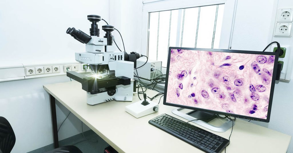 Scientists Show Early Promise in Reversing Parkinson’s Symptoms Using Lab-Grown Brain Cells - Featured image