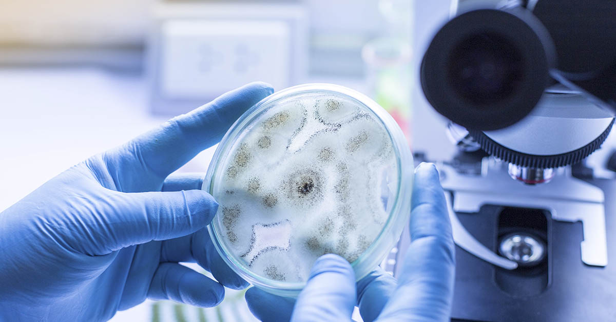 petri dish containing a culture of Aspergillus niger, a common filamentous fungus