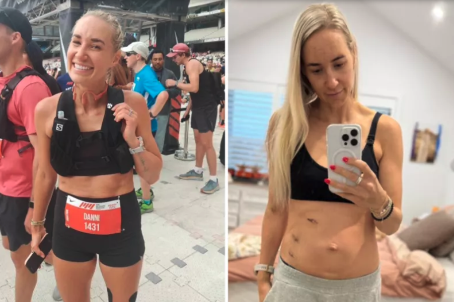 Left: Duncan participating in a marathon event in February, where she had couldn't continue. Right: A mirror selfie showing surgical scars on her abdomen.