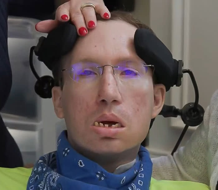 Jonathan Buckelew using eye-tracking technology to control a computer interface, demonstrating assistive technology for locked-in syndrome.