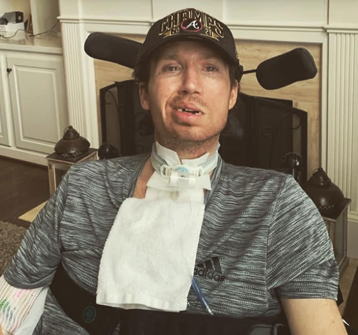 Jonathan Buckelew in his wheelchair wearing a cap, representing his life with locked-in syndrome after his stroke from a neck adjustment.