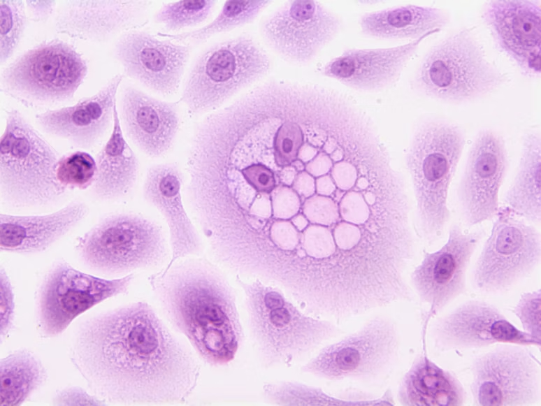 cancer cells under a microscope