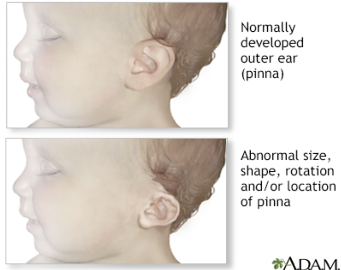 baby's ear