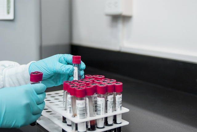 blood samples