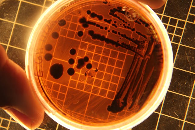 E. coli