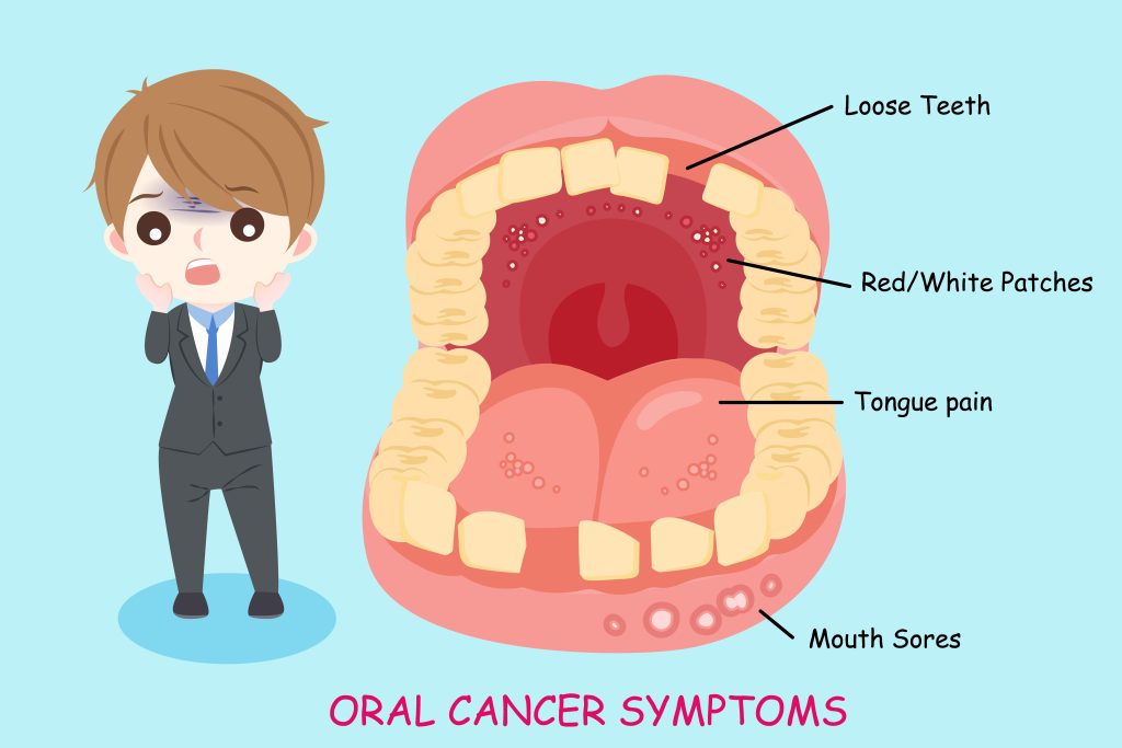 man with oral cancer symptoms on the blue background
