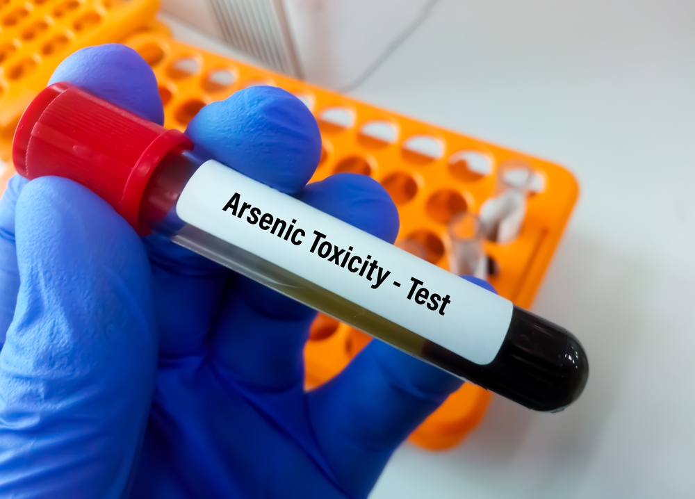 Blood sample for Arsenic toxicity test. Arsenic is a heavy metal element. High levels of arsenic may have arsenic poisoning