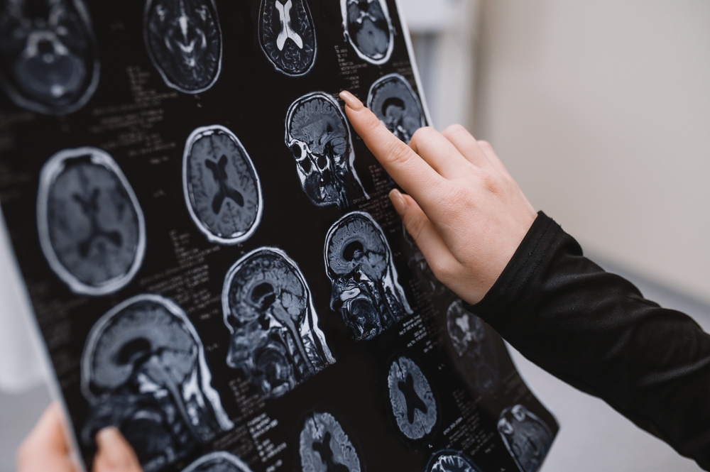 Close-up MRI of the brain, the doctor studies and analyzes the results of the study and diagnosis. Hand and finger close-up touching MRI scan