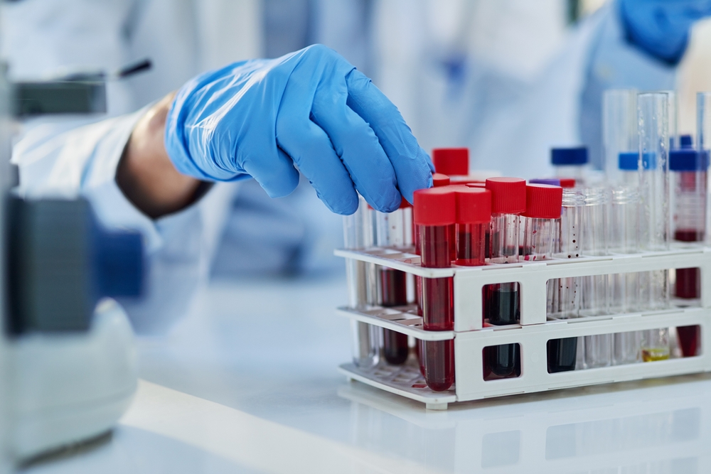 Science, blood test and hands of person with sample for biotech engineering, pathology and hematology research. Laboratory, exam and scientist with glucose analysis, development or medical study.