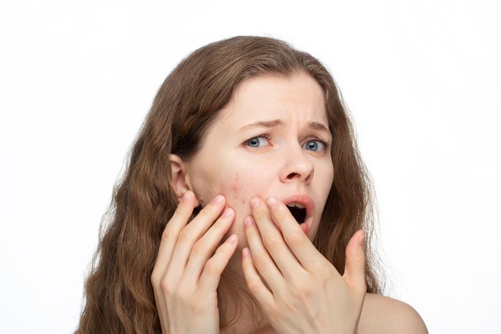 A beautiful young woman with real acne and pimples examines her skin closely. She appears surprised, upset, and frustrated by the breakouts.White background.