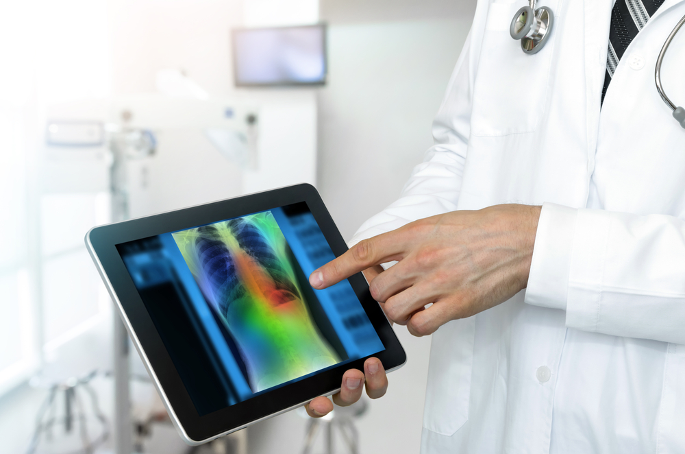 Artificial intelligence in smart healthcare hospital technology concept. Professional doctor use AI biomedical algorithm detect Pneumonia and cancer cell in digital filmless X-Rays process.