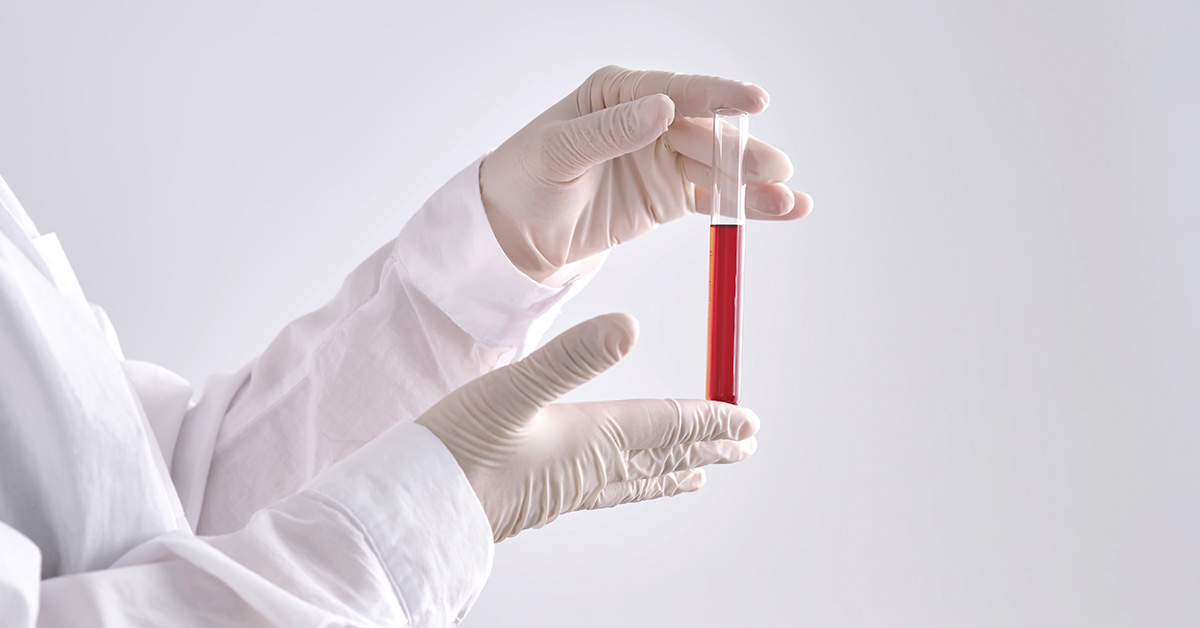 person holding vile of blood
