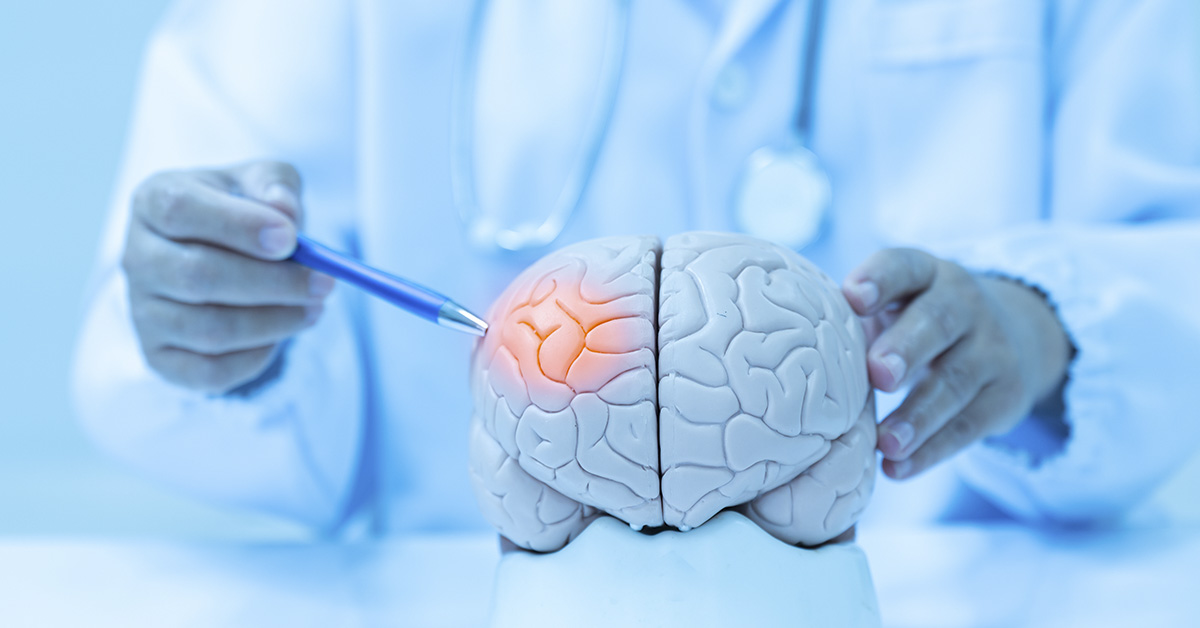 medical professional examining a model of the brain. Brain health and stroke risk concept