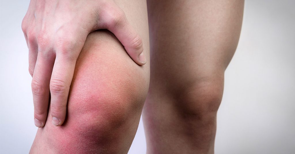 7 Causes of a Swollen Knee and When to See a Doctor - Featured image